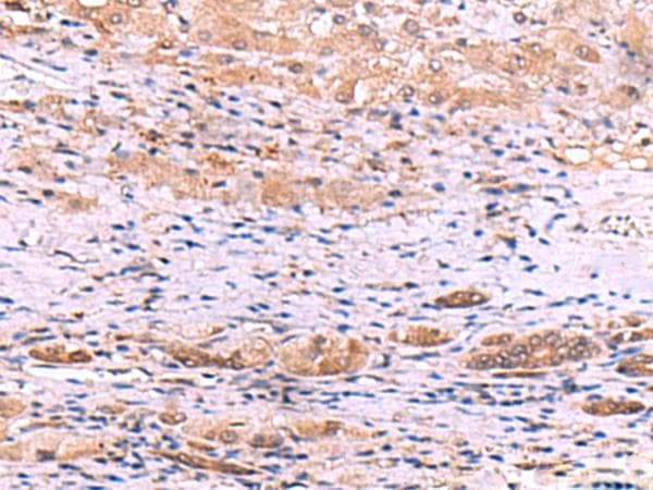 Polyclonal Rabbit anti-Human DHPS Antibody (IHC)