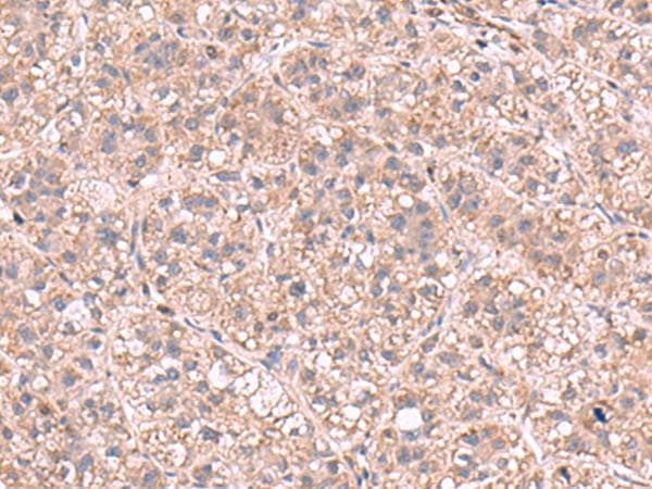 Polyclonal Rabbit anti-Human KPNA2 / Importin Alpha 1 Antibody (IHC)