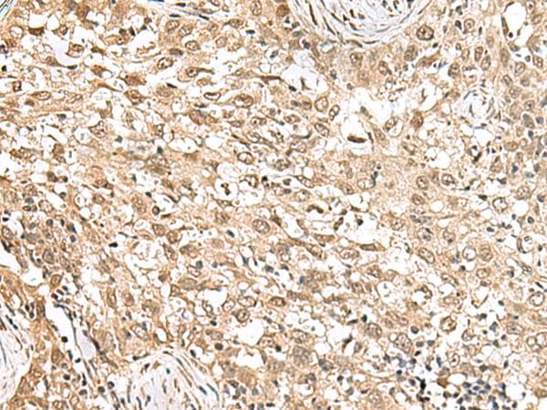 Polyclonal Rabbit anti-Human RPS6KA5 / MSK1 Antibody (IHC)