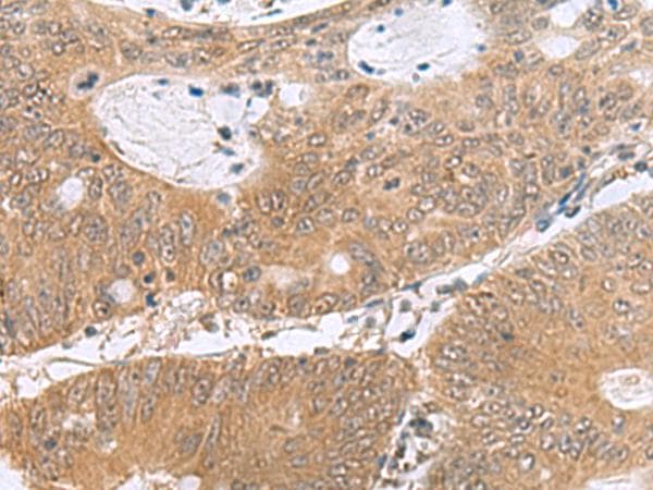 Polyclonal Rabbit anti-Human PHPT1 Antibody (IHC, WB)