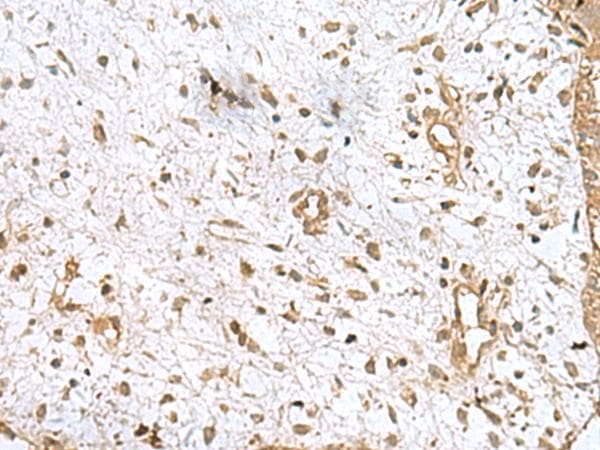 Polyclonal Rabbit anti-Human AK5 / Adenylate Kinase 5 Antibody (IHC)