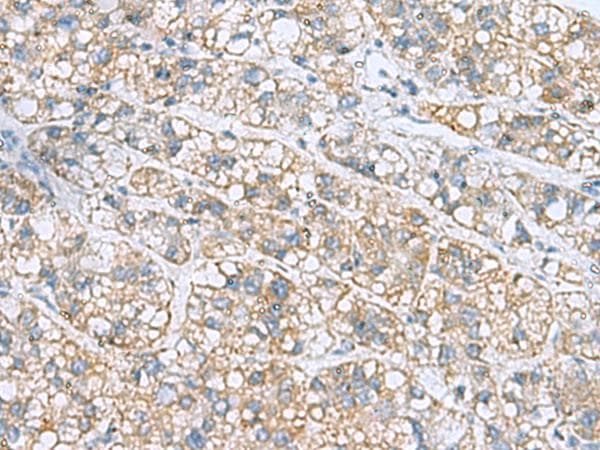Polyclonal Rabbit anti-Human NANP Antibody (IHC)