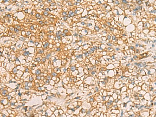 Polyclonal Rabbit anti-Human AIMP1 / EMAP II Antibody (IHC)