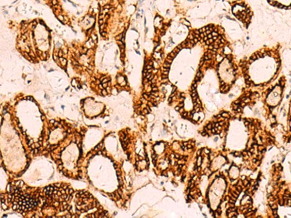 EPCAM Antibody