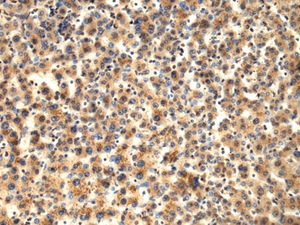 Polyclonal Rabbit anti-Human TMOD1 / Tropomodulin 1 Antibody (IHC)