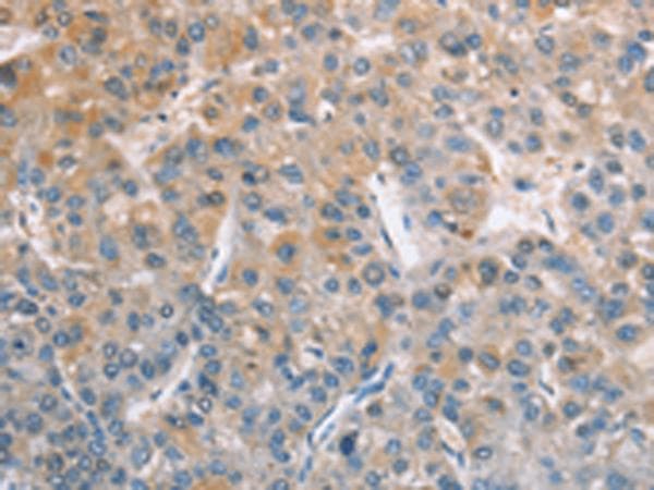 Polyclonal Rabbit anti-Human ZAP70 Antibody (IHC, WB)