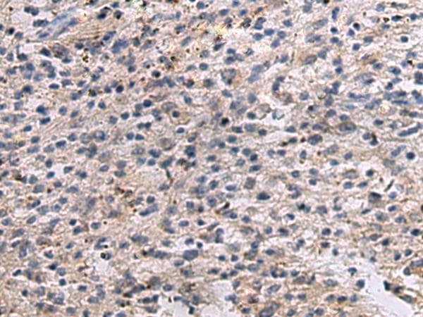 Polyclonal Rabbit anti-Human ANGPTL2 / ARP2 Antibody (IHC)