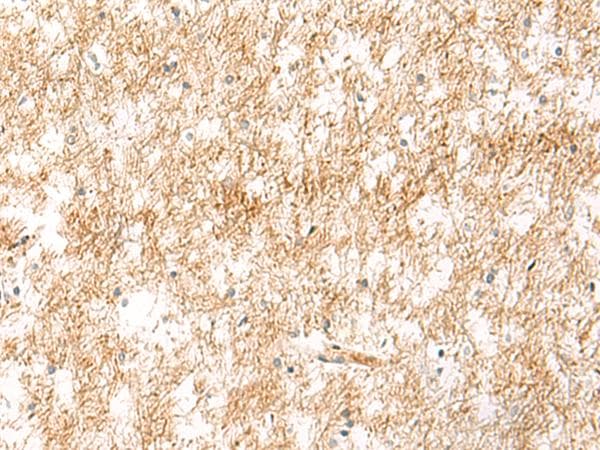 Polyclonal Rabbit anti-Human XPC Antibody (IHC)