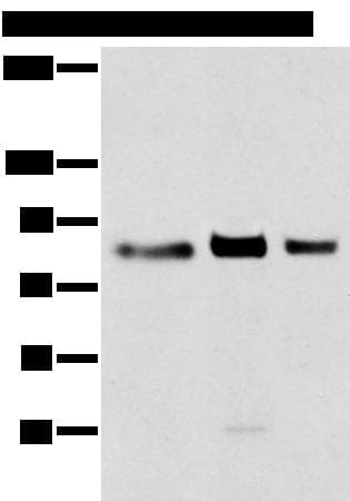 Polyclonal Rabbit anti-Human TBX3 Antibody (WB)