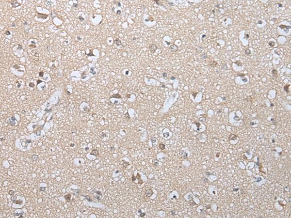 Polyclonal Rabbit anti-Human GZMM / Granzyme M Antibody (IHC, WB)