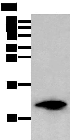 Polyclonal Rabbit anti-Human FSHB / FSH Beta Antibody (WB)