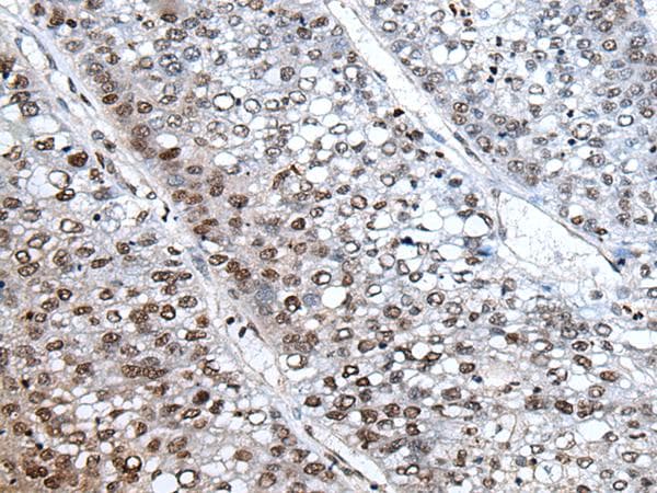 HIST1H3A Antibody
