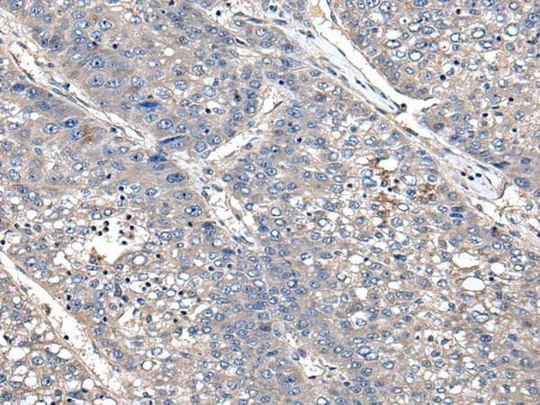 Polyclonal Rabbit anti-Human XDH / Xanthine Oxidase Antibody (IHC)