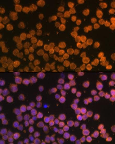 Polyclonal Rabbit anti-Human TNFRSF10A / DR4 Antibody (IF)