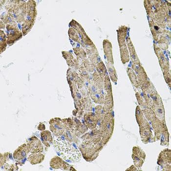Polyclonal Rabbit anti-Human IKBKG / NEMO / IKK Gamma Antibody (IHC)