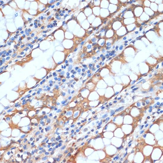 HHLA2 Antibody