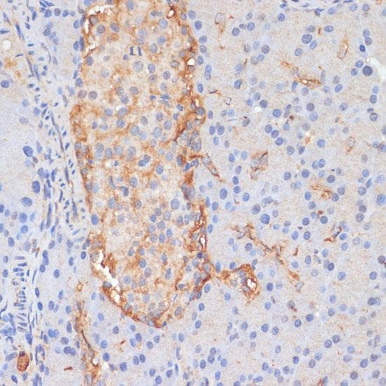 Polyclonal Rabbit anti-Human DLL1 Antibody (IHC)