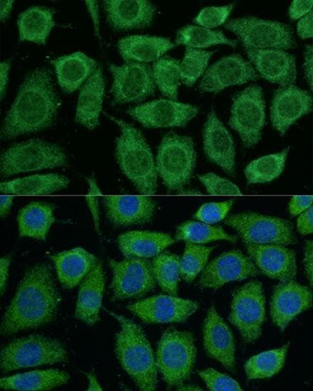 Polyclonal Rabbit anti-Human DLAT / PDC-E2 Antibody (IHC, IF, WB)