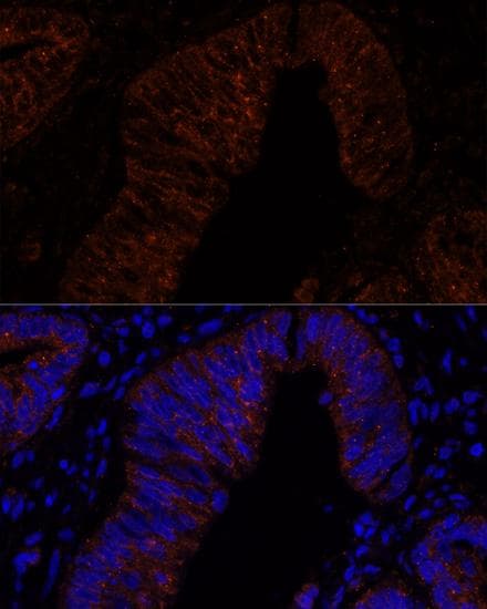 Polyclonal Rabbit anti-Human Mucin 2 / MUC2 Antibody (IF)