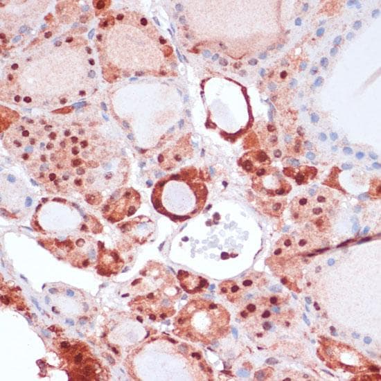 Polyclonal Rabbit anti-Human S100A5 Antibody (IHC)