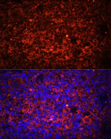 Polyclonal Rabbit anti-Human TLR8 Antibody (IF, WB)