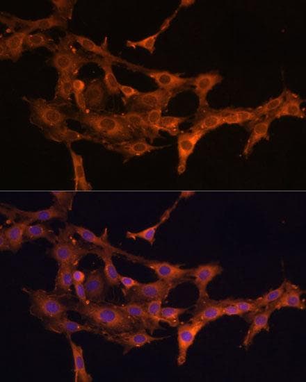 Polyclonal Rabbit anti-Human DCN / Decorin Antibody (IF)
