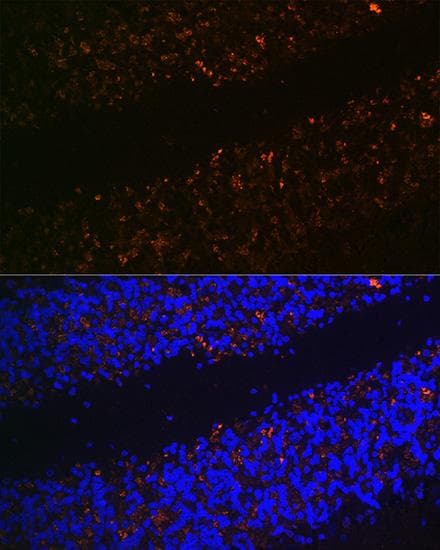 SLC17A6 / VGLUT2 Antibody
