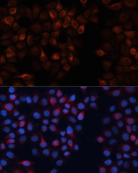Polyclonal Rabbit anti-Human CANX / Calnexin Antibody (IF)