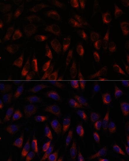Polyclonal Rabbit anti-Human SLC9A1BP / CHP Antibody (IF)