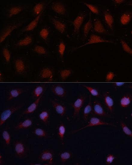 Polyclonal Rabbit anti-Human PYCARD / ASC / TMS1 Antibody (IHC, IF)