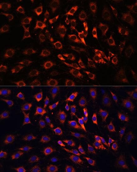 Polyclonal Rabbit anti-Human ERK1 + ERK2 Antibody (IHC, IF)