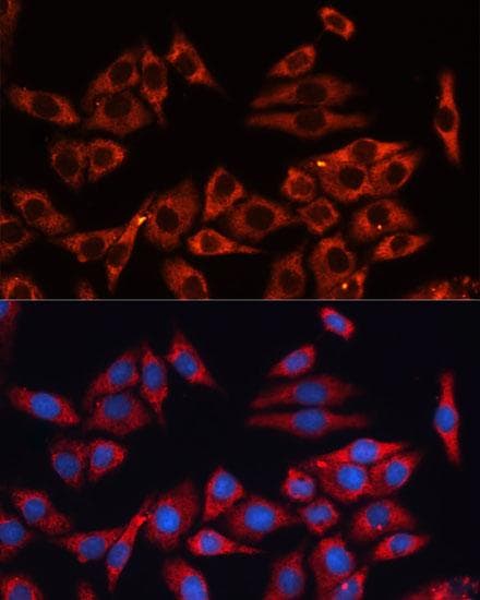 Polyclonal Rabbit anti-Human ERK1 + ERK2 Antibody (IF)