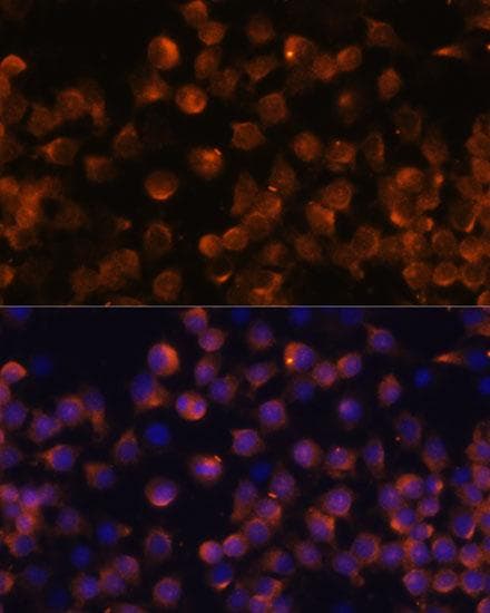 Polyclonal Rabbit anti-Human CFB / Complement Factor B Antibody (IHC, IF, WB)