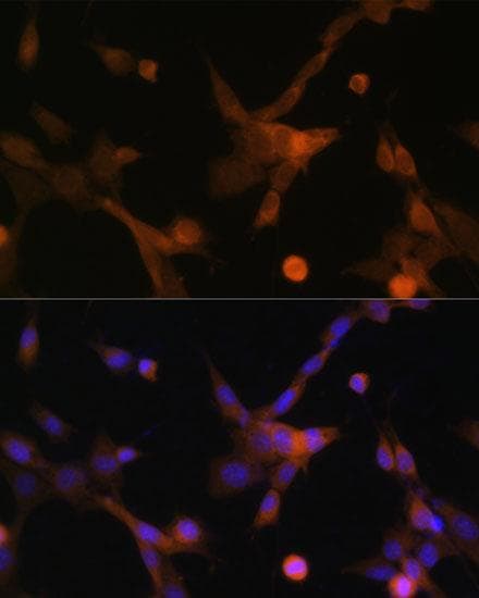 Polyclonal Rabbit anti-Human BBC3 / PUMA Antibody (IF, WB)