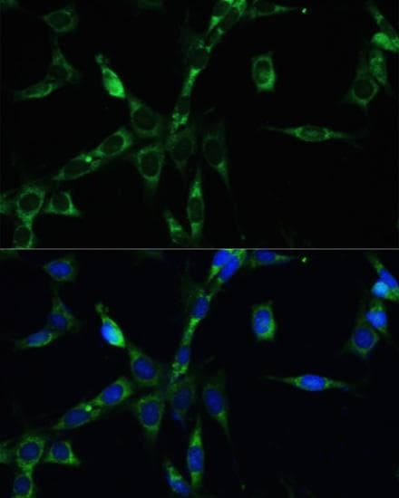 Polyclonal Rabbit anti-Human BUB1B / BubR1 Antibody (IHC, IF)
