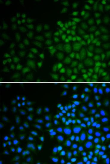 Polyclonal Rabbit anti-Human NR0B2 Antibody (IHC, IF)