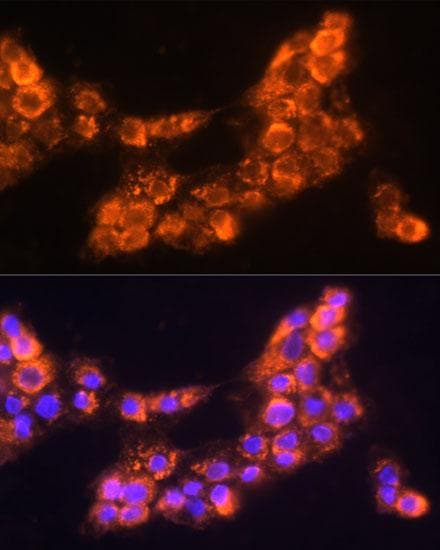 Polyclonal Rabbit anti-Human LAMC2 / Laminin Gamma 2 Antibody (IF)