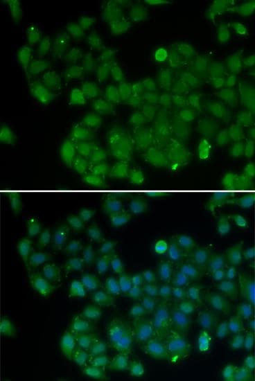Polyclonal Rabbit anti-Human DNMT3L Antibody (IHC, IF)
