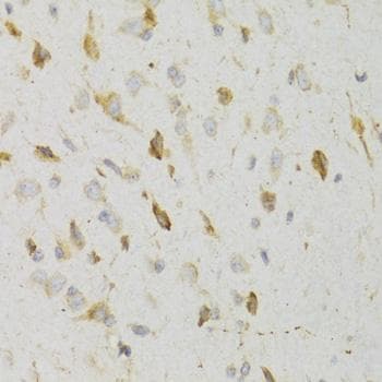 Polyclonal Rabbit anti-Human KISS1R / GPR54 Antibody (IHC, WB)