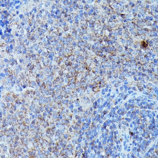 Polyclonal Rabbit anti-Human CSF3 / G-CSF Antibody (IHC)