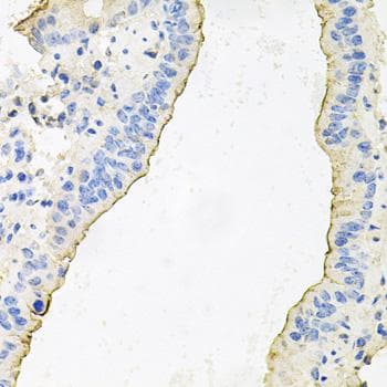 Polyclonal Rabbit anti-Human HPR Antibody (IHC)