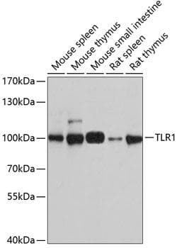 Polyclonal Rabbit anti-Human TLR1 Antibody (WB)