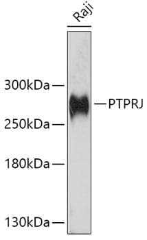Polyclonal Rabbit anti-Human PTPRJ / CD148 Antibody (WB)