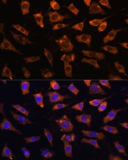 Polyclonal Rabbit anti-Human CYR61 Antibody (IF)