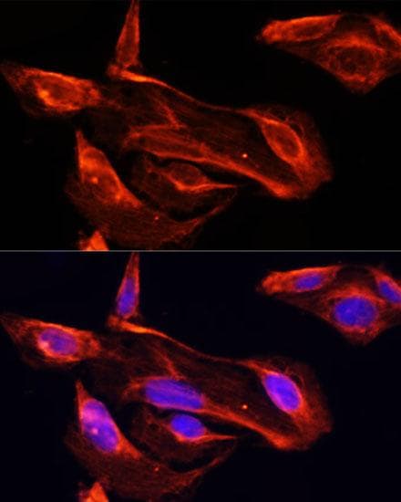Polyclonal Rabbit anti-Human MMP2 Antibody (IF)