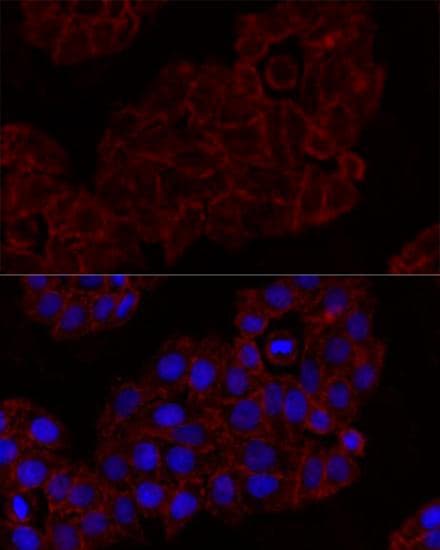 Polyclonal Rabbit anti-Human KLRK1 / CD314 / NKG2D Antibody (IF)