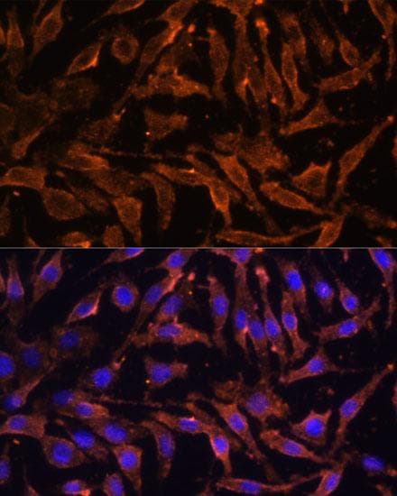 Polyclonal Rabbit anti-Human TNFRSF11A / RANK Antibody (IF)