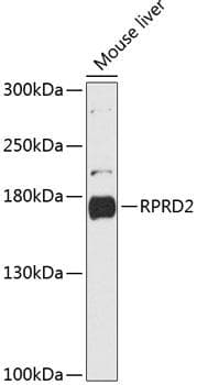 Polyclonal Rabbit anti-Human RPRD2 Antibody (WB)
