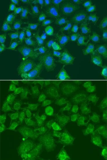 Polyclonal Rabbit anti-Human CST1 / Cystatin SN Antibody (IF)