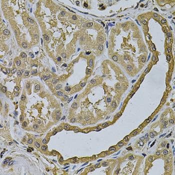 Polyclonal Rabbit anti-Human LCP1 / L-Plastin Antibody (IHC)